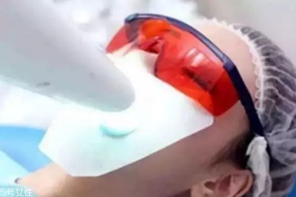 如何正确使用美牙仪 美牙仪伤牙齿吗