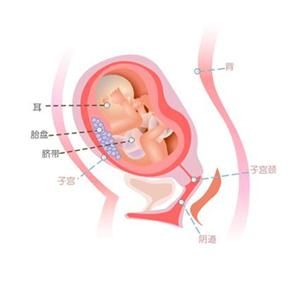 怀孕26周胎儿图