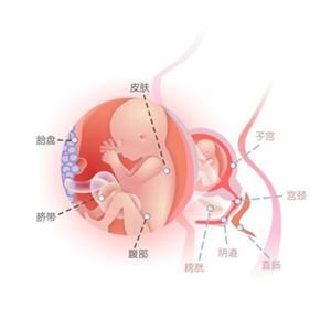 怀孕20周症状_怀孕20周注意事项、胎儿图