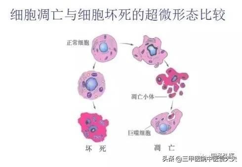 高血压心脏病糖尿病发病率（高血压肿瘤糖尿病等常见的慢性病基本上都是循环系统变差导致）(3)