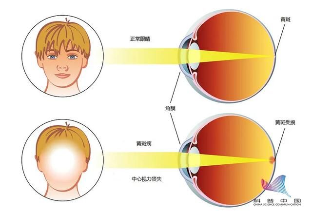 长期夜间关灯看手机会导致失明吗（关灯玩手机会导致失明）(3)