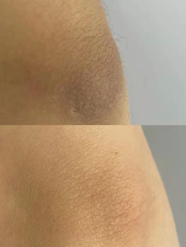 去鸡皮磨砂膏平价好用推荐（20款磨砂膏测评推荐分享）(2)