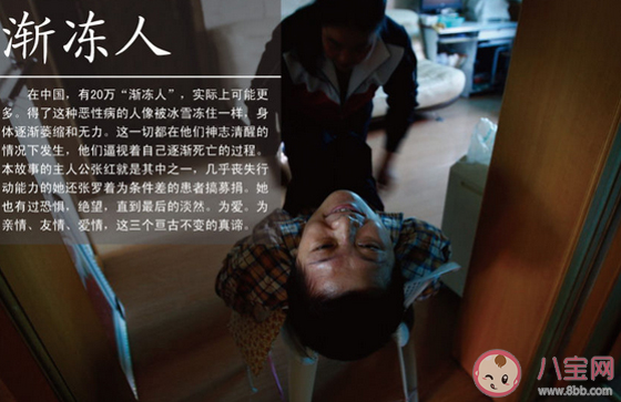 关于罕见病以下说法正确的是 蚂蚁庄园2月28日答案介绍