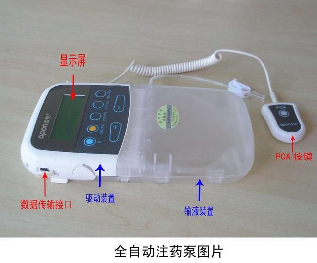 止痛泵的作用和使用方法（止痛泵在临床如何应用）