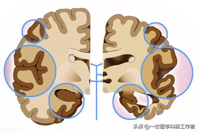 一直玩手机对大脑会有什么后果（你每天玩手机时间多长）