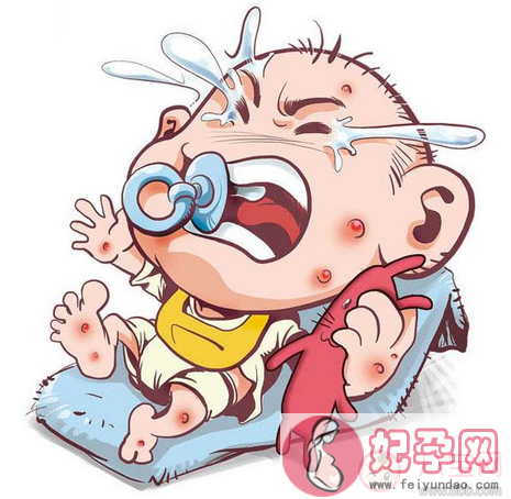 宝宝湿疹最佳治疗方法 宝宝湿疹的症状有哪些