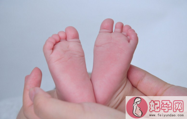 脚气真的会传染吗 预防宝宝脚气有哪些做法
