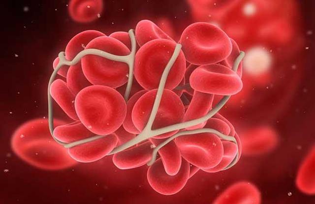 夫妻血型不合 胎儿则会缺少血型抗原
