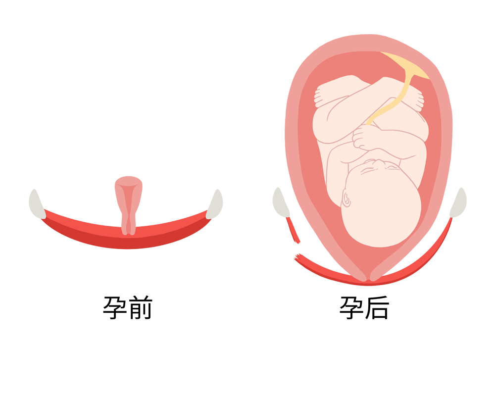 做好盆底肌修复 重启产后性福之门