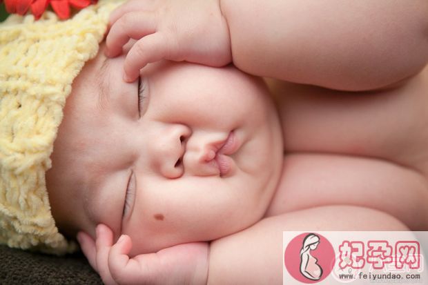 宝宝婴儿肥真的不用在意吗  婴儿肥会持续多久才正常