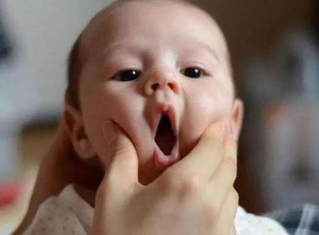 宝宝嘴唇干怎么办？引起宝宝嘴唇干的原因是什么？