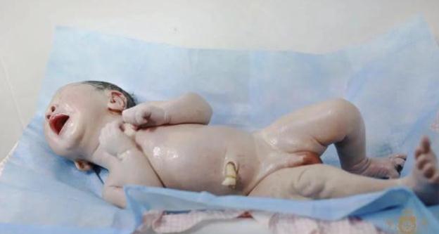 宝宝出生后 被医生姐姐抱走的十分钟都做了什么？